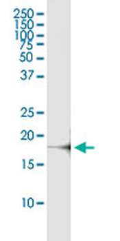 CSF3 MaxPab rabbit polyclonal antibody (D01)