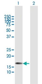 CSF3 MaxPab rabbit polyclonal antibody (D01)
