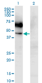 CSF2RA monoclonal antibody (M03), clone 2G5