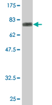 CSF2RA monoclonal antibody (M03), clone 2G5