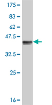 CSF1R monoclonal antibody (M02), clone 3G12