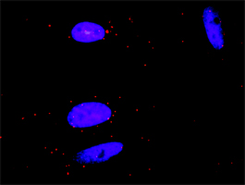 CSF1R monoclonal antibody (M01), clone 1G4