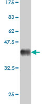 CSF1R monoclonal antibody (M01), clone 1G4