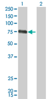 CSF1 monoclonal antibody (M01), clone 1A9