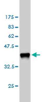CSF1 monoclonal antibody (M01), clone 1A9