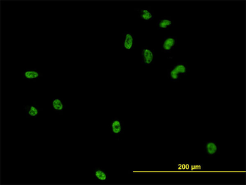 CSE1L monoclonal antibody (M08), clone 3D8