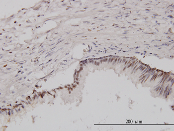CSE1L monoclonal antibody (M08), clone 3D8
