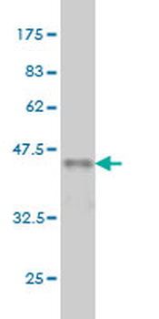 CSE1L monoclonal antibody (M08), clone 3D8
