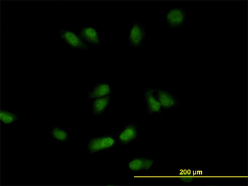 CSE1L monoclonal antibody (M05), clone 3F8