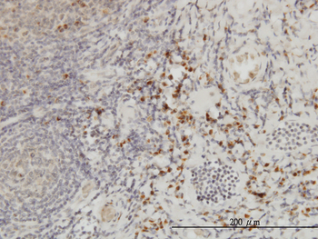 CSE1L monoclonal antibody (M05), clone 3F8