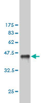 CSE1L monoclonal antibody (M05), clone 3F8