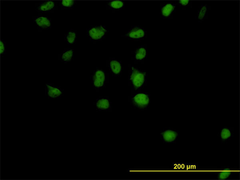 CSE1L monoclonal antibody (M04), clone 2F4
