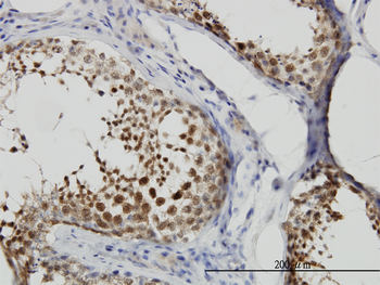 CSE1L monoclonal antibody (M04), clone 2F4
