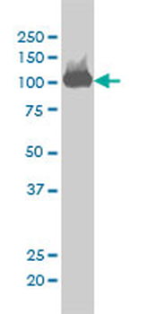 CSE1L monoclonal antibody (M03), clone 2C10