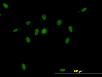 CSE1L monoclonal antibody (M03), clone 2C10