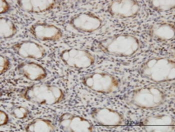 CSE1L monoclonal antibody (M03), clone 2C10