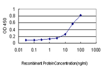 CSE1L monoclonal antibody (M02), clone 1E4
