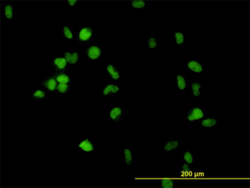 CSE1L monoclonal antibody (M02), clone 1E4