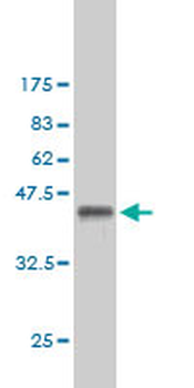 CSE1L monoclonal antibody (M02), clone 1E4