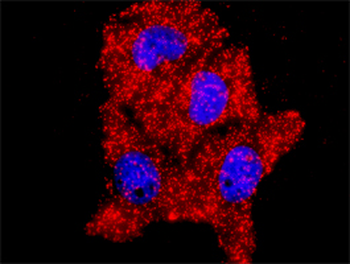 MAPK14 monoclonal antibody (M01), clone 3D5