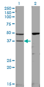 MAPK14 monoclonal antibody (M01), clone 3D5