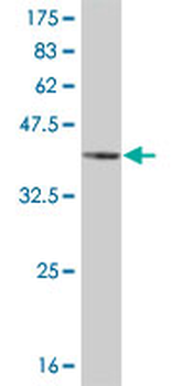MAPK14 monoclonal antibody (M01), clone 3D5