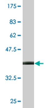 CRYM monoclonal antibody (M09), clone 1C6