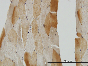 CRYM monoclonal antibody (M03), clone 6B3