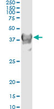 CRYM monoclonal antibody (M03), clone 6B3