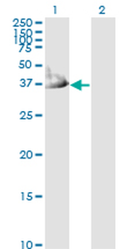 CRYM monoclonal antibody (M03), clone 6B3