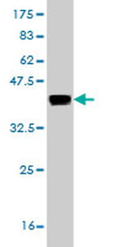 CRYM monoclonal antibody (M03), clone 6B3