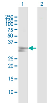 CRYM MaxPab rabbit polyclonal antibody (D01)