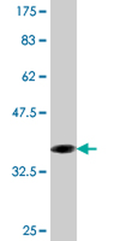 CRYGD monoclonal antibody (M04), clone 2H3