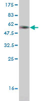 CRYGD monoclonal antibody (M03), clone 4E12