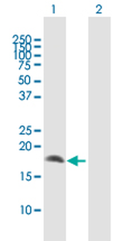 CRYGD MaxPab rabbit polyclonal antibody (D01)