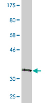 CRYBB3 monoclonal antibody (M01), clone 4H6