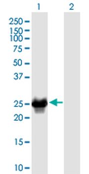 CRYBB2 monoclonal antibody (M02), clone 1F1