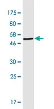 CRYBB2 monoclonal antibody (M02), clone 1F1