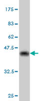 CRYBB1 monoclonal antibody (M03), clone 3D9
