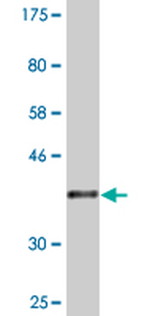 CRYBA4 monoclonal antibody (M01), clone 1D7