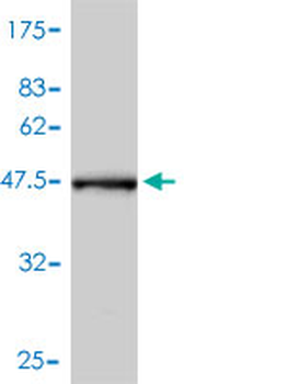 CRYAB monoclonal antibody (M01), clone 1A10-1A4