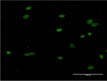 CRY1 monoclonal antibody (M02), clone 2G4-1F6