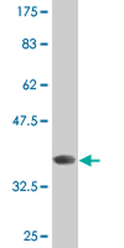 CRMP1 monoclonal antibody (M50), clone 2B6