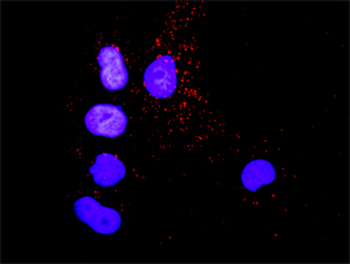 CRK purified MaxPab rabbit polyclonal antibody (D01P)