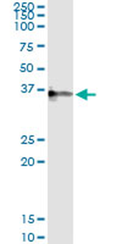 CRHBP monoclonal antibody (M01), clone 3D9