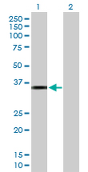 CRHBP purified MaxPab rabbit polyclonal antibody (D01P)