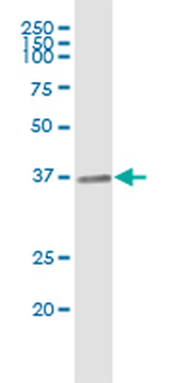 CRHBP MaxPab rabbit polyclonal antibody (D01)