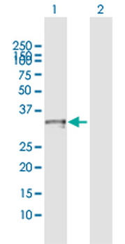 CRHBP MaxPab rabbit polyclonal antibody (D01)