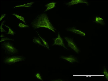 CREBL1 monoclonal antibody (M02), clone 4D10