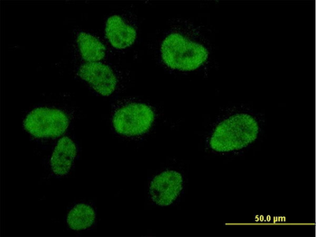CREBBP monoclonal antibody (M01), clone 2H5